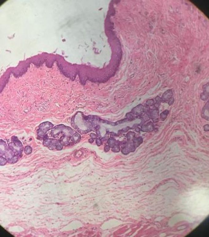 Histology of oesophagus
