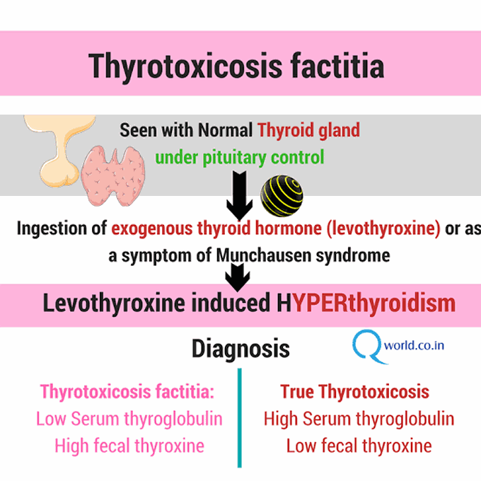 Thyrotoxicosis Factitia