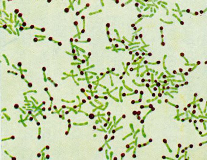 Corynebacterium on Albert staining