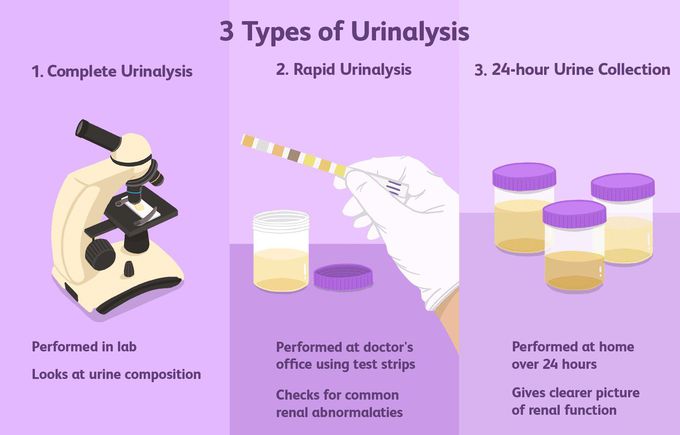 Urinalysis