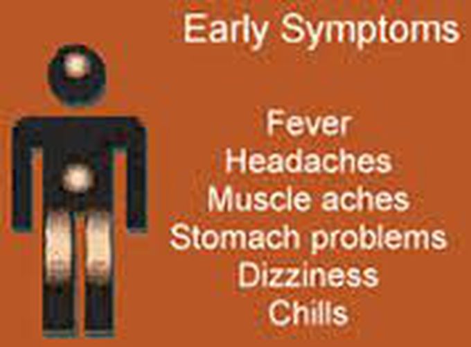 These are the symptoms of Hantavirus syndrome