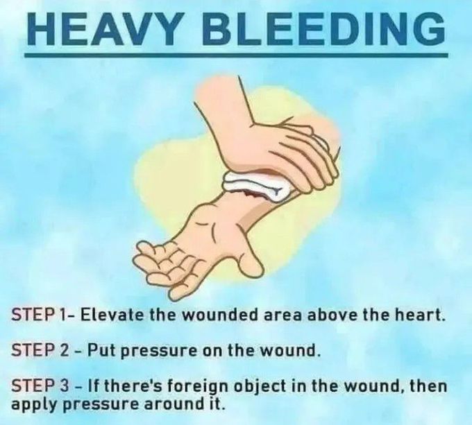 Steps to stop bleeding