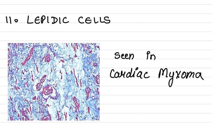 Lepidic Cells