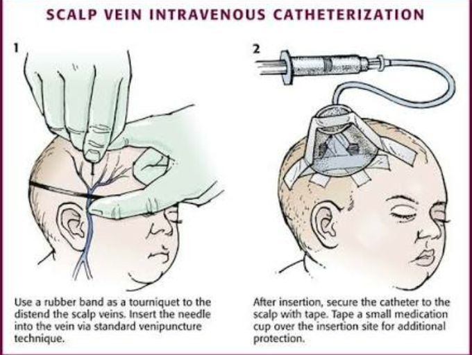 Scalp перевод. Scalp Cotril. Scalp Normalizing. Scalp Routine.