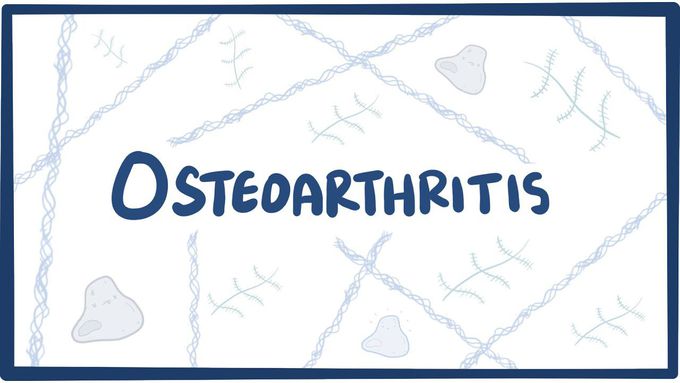Osteoarthritis