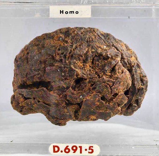 Cerebral hemisphere of an ancient Egyptian :)