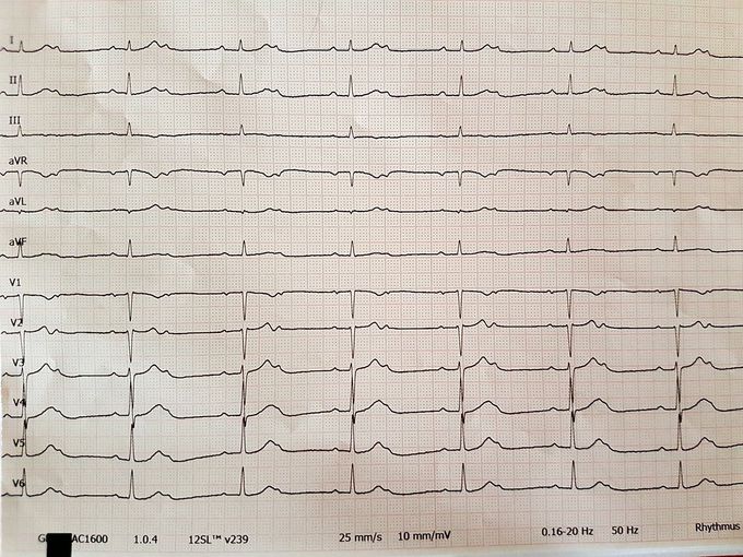 What's the Dx? What is Tx?