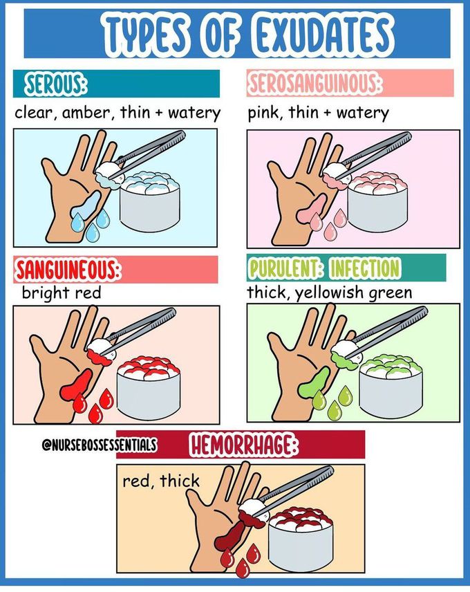 Types of Exudates