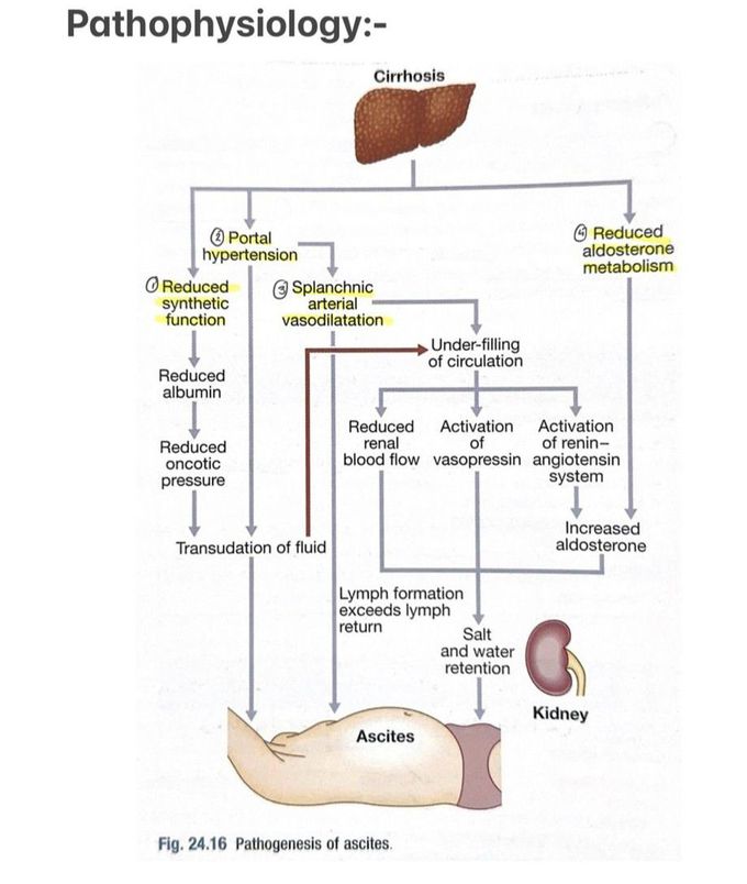 Ascites II