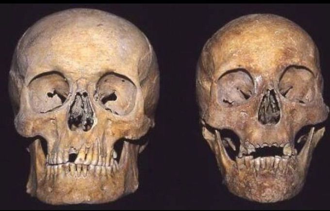 Sex Differences in Human Skeletons