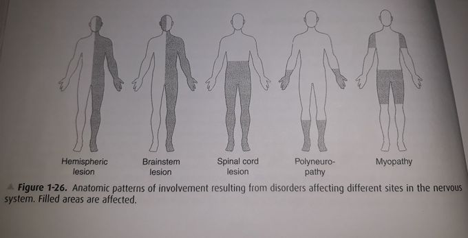 Neurological diseases patterns