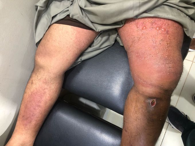 Can you dx this?