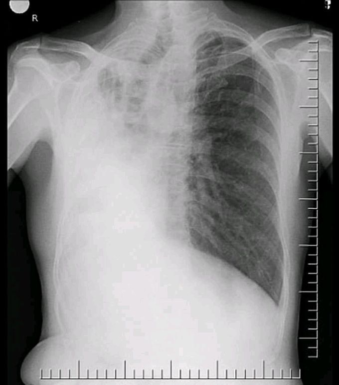 What is your diagnosis?