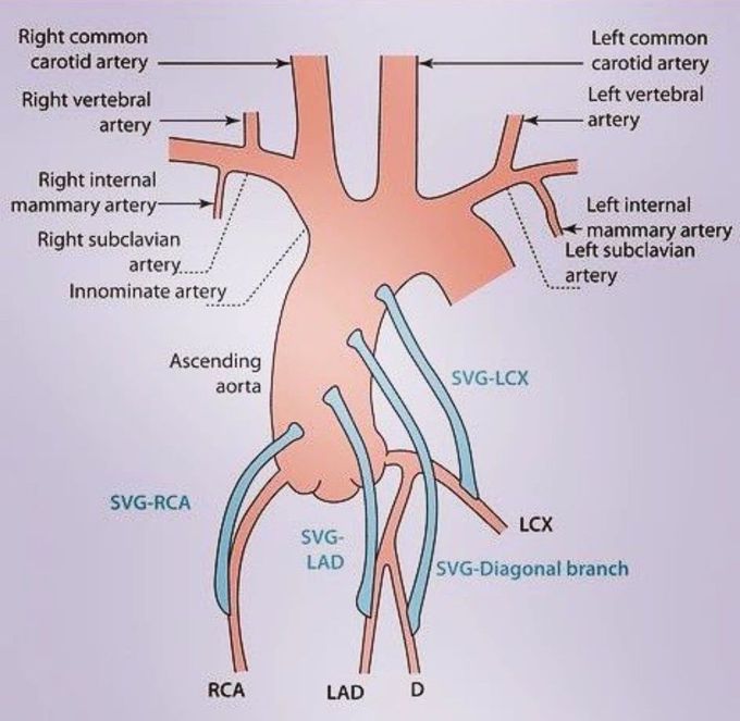 Ascending Aorta Anatomy