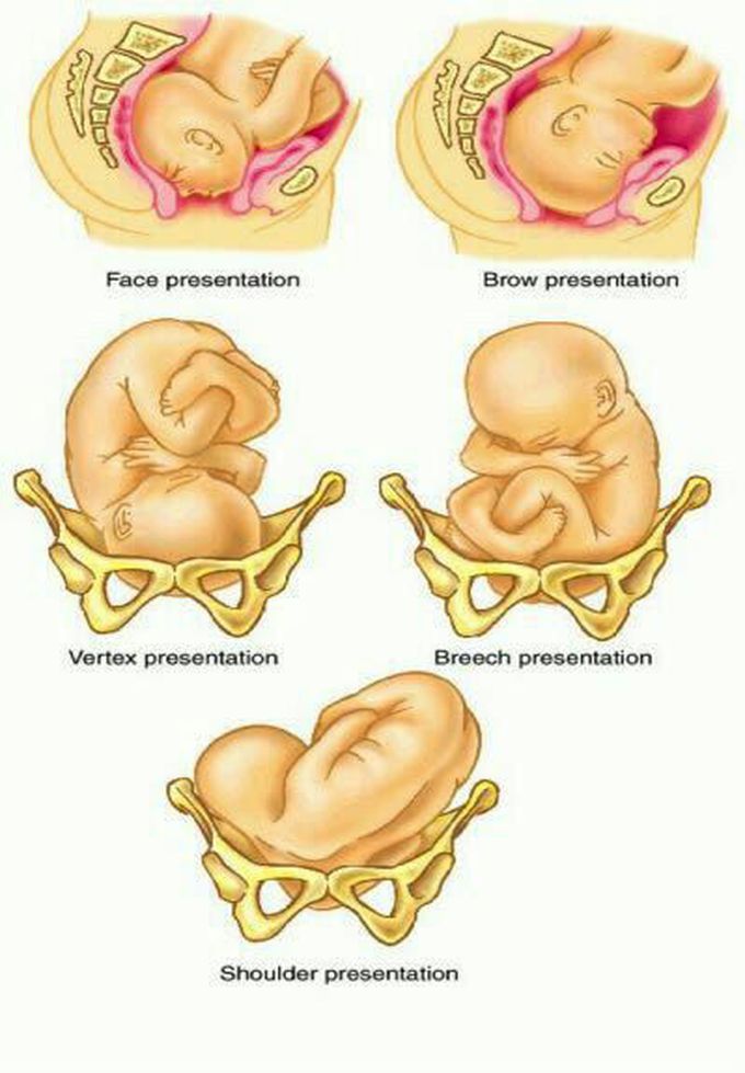 Presentation