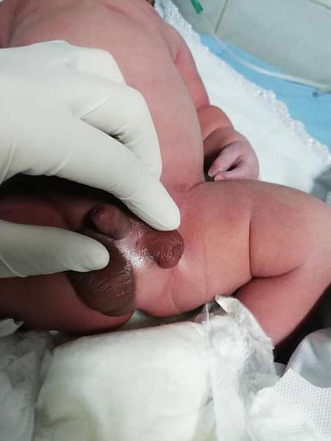 bofid scrotum