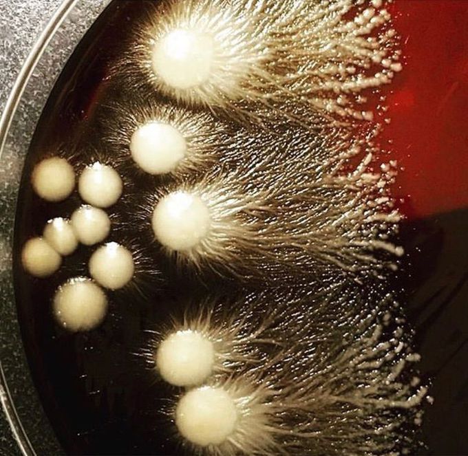 Candida albicans
