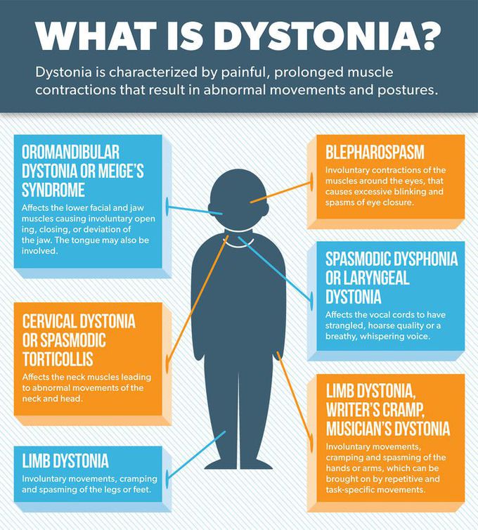 dystonic cramps.