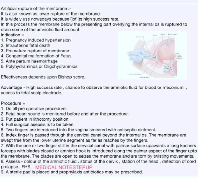 Artificial Rupture of the Membrane