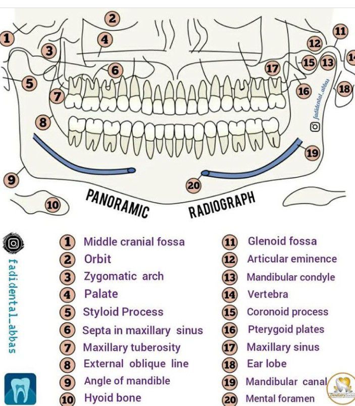 Panoramic Radiographic Anatomy