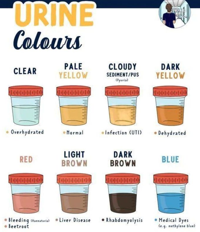 Urine Colors