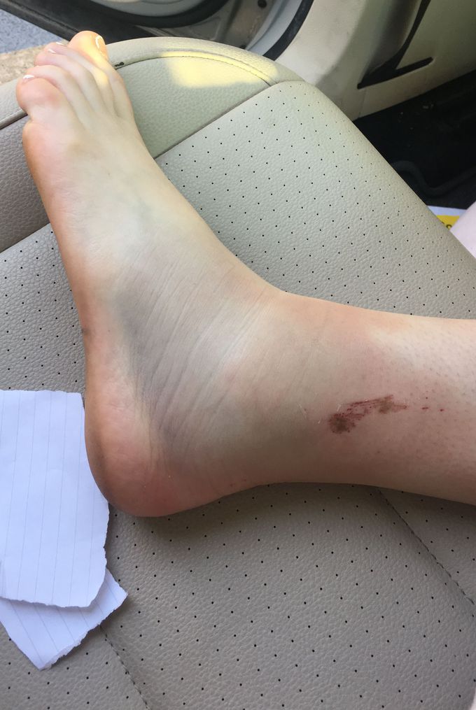 Diagnosis?