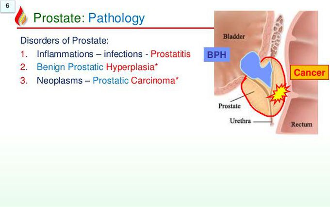 Prostate