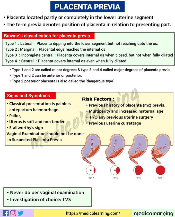 Placenta Previa