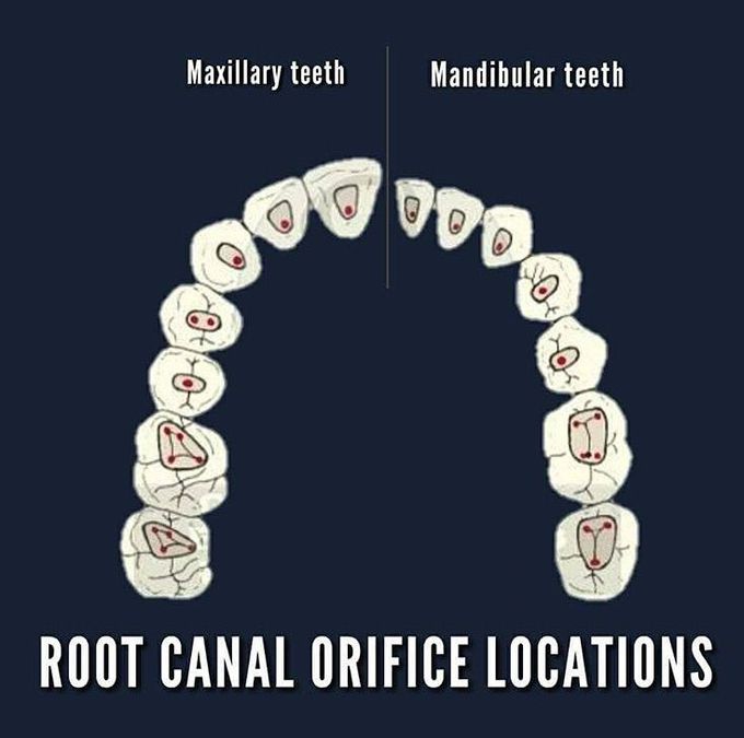 Root canal orifice locations in maxillary & mandibular teeth. 😍😷