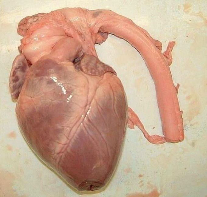 Human heart with the aorta