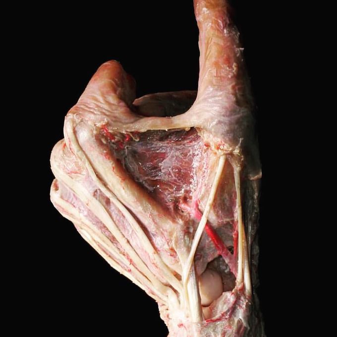 A Hand with no superficial layers. 