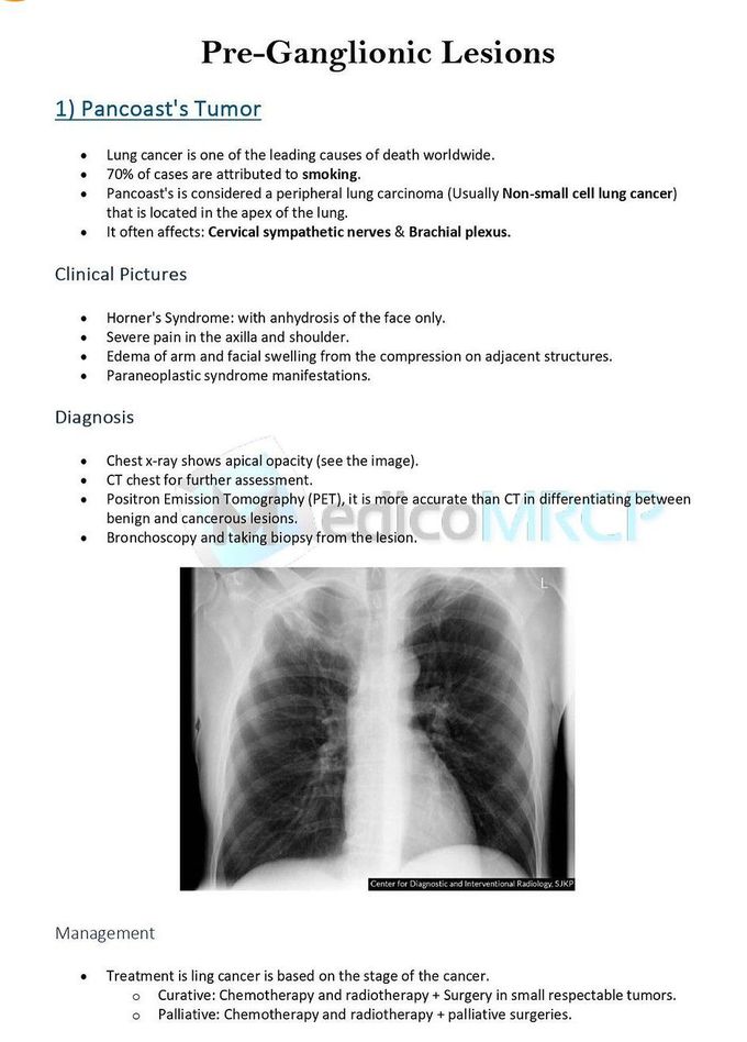 Pancoast's Tumor