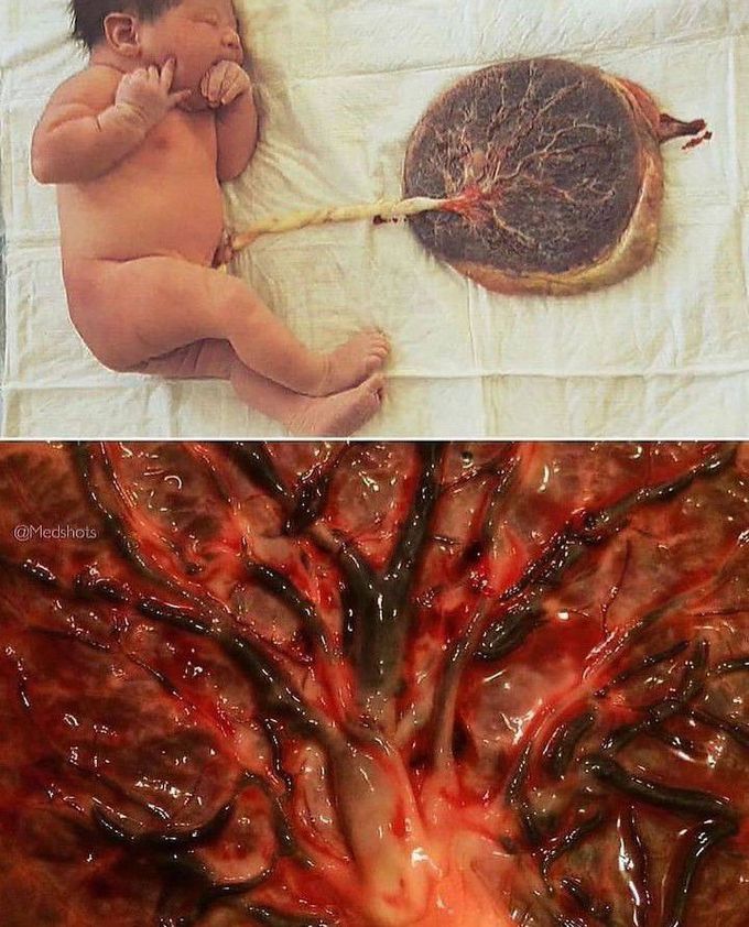 The Magnificent Placenta