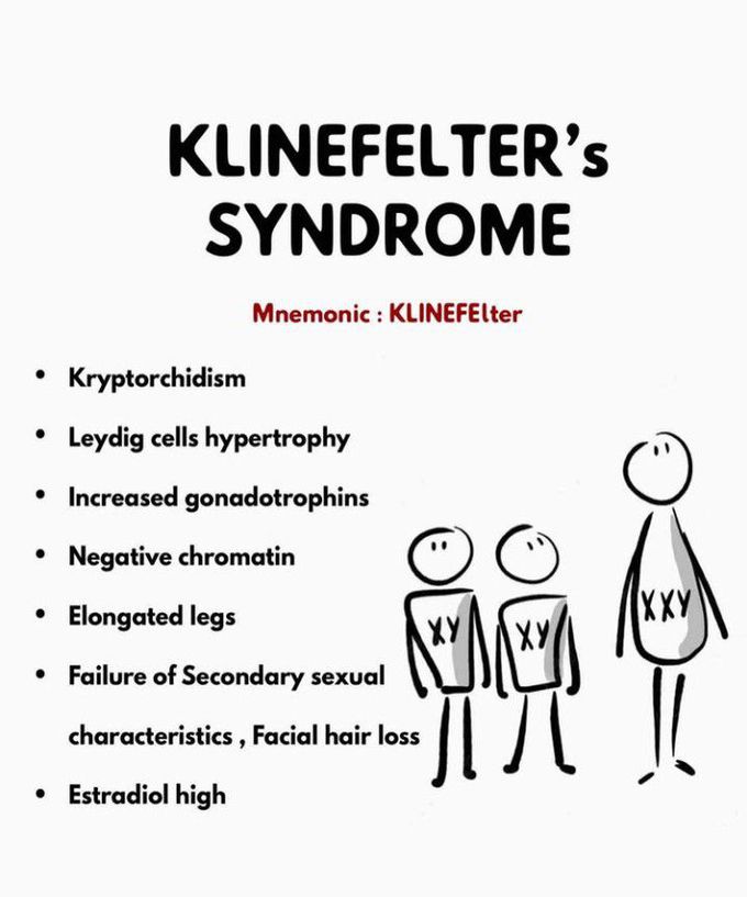 Klinefelter's Syndrome