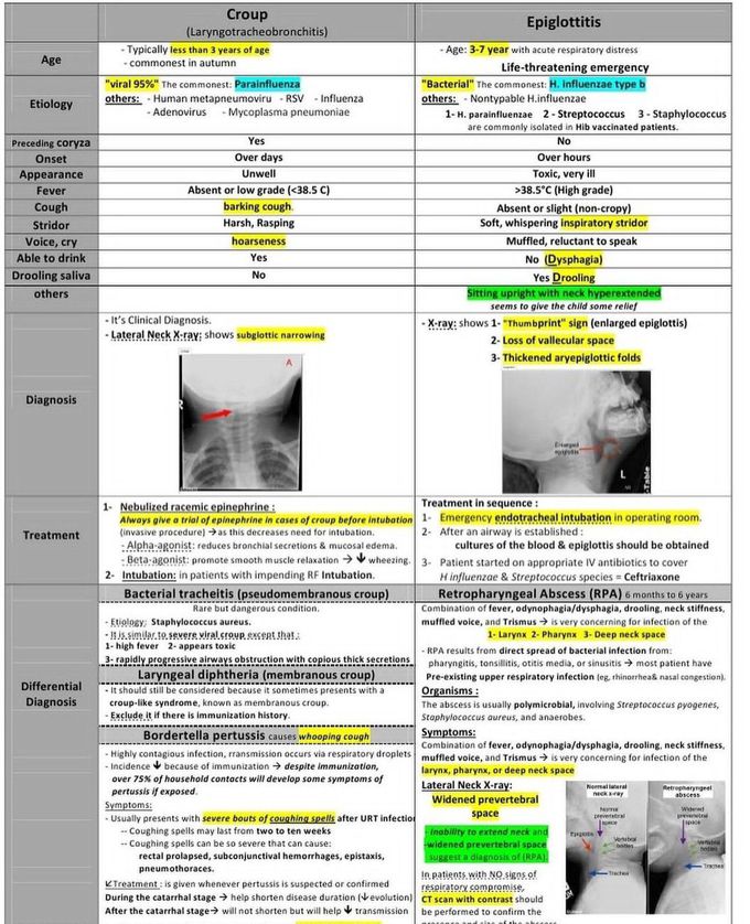 Croup Vs Epiglottitis -II