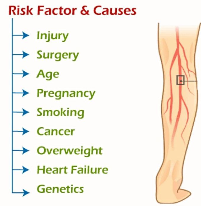 DVT-Risk Factors