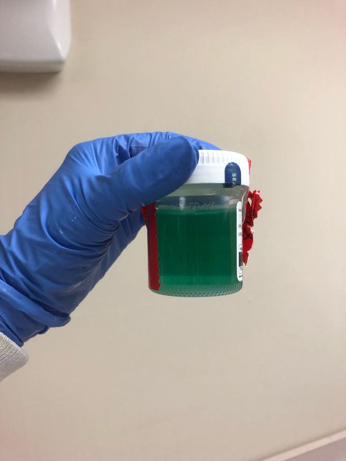 Green urine in patient in pain management clinic