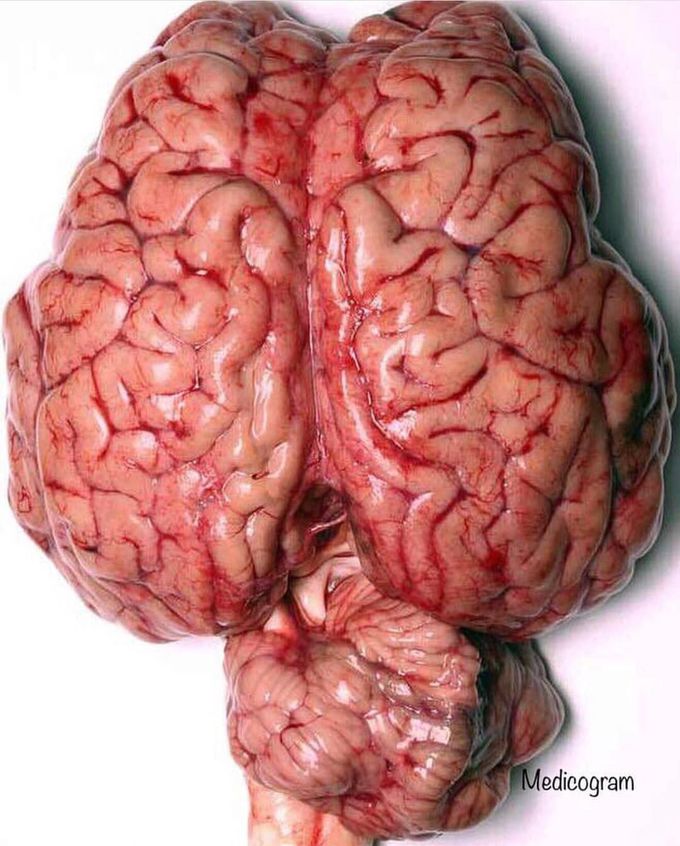 Real photograph of the human brain, portraying its superior view