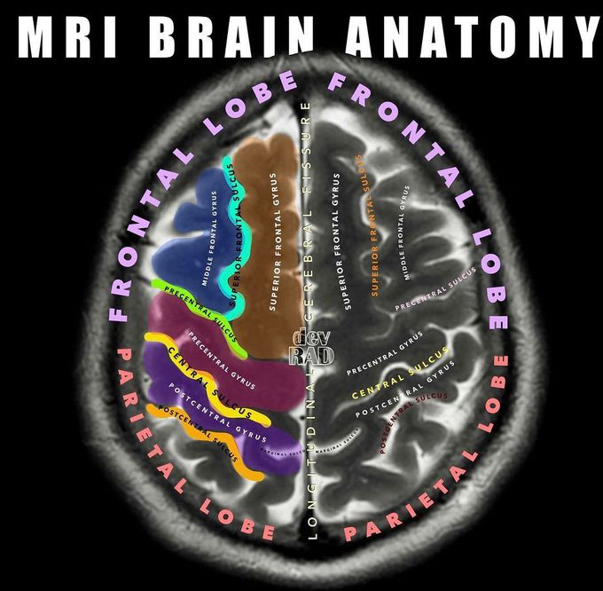 MRI Brain Anatomy