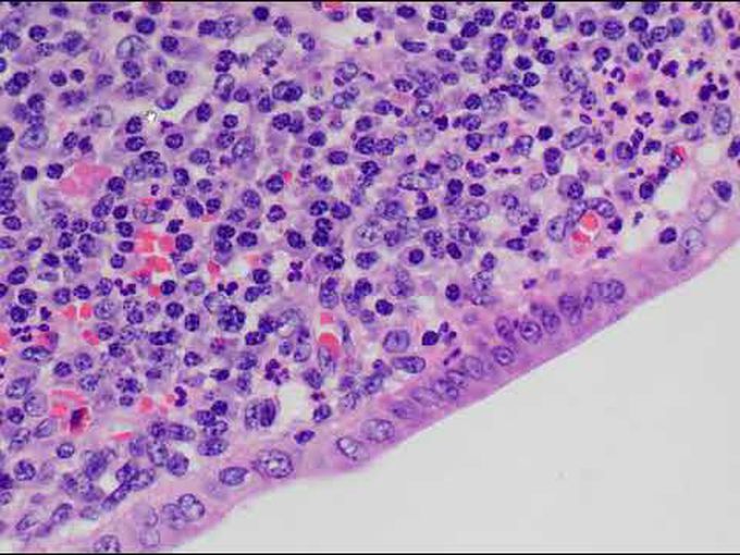 Leukocytes-Connective Tissue