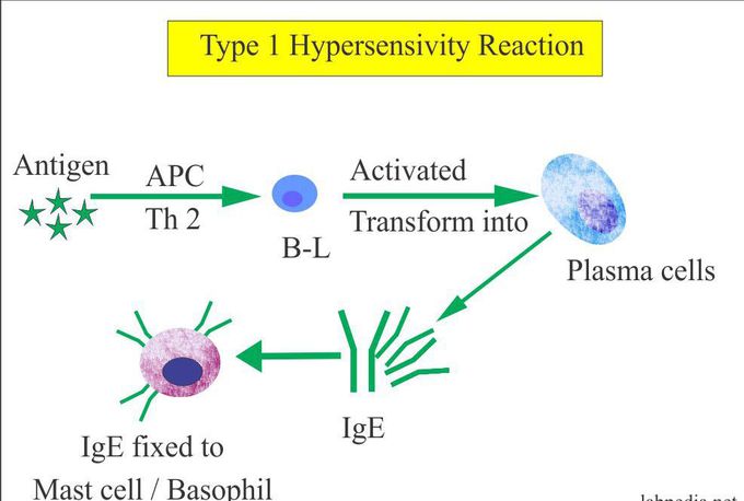 Type I Hypersensitivity