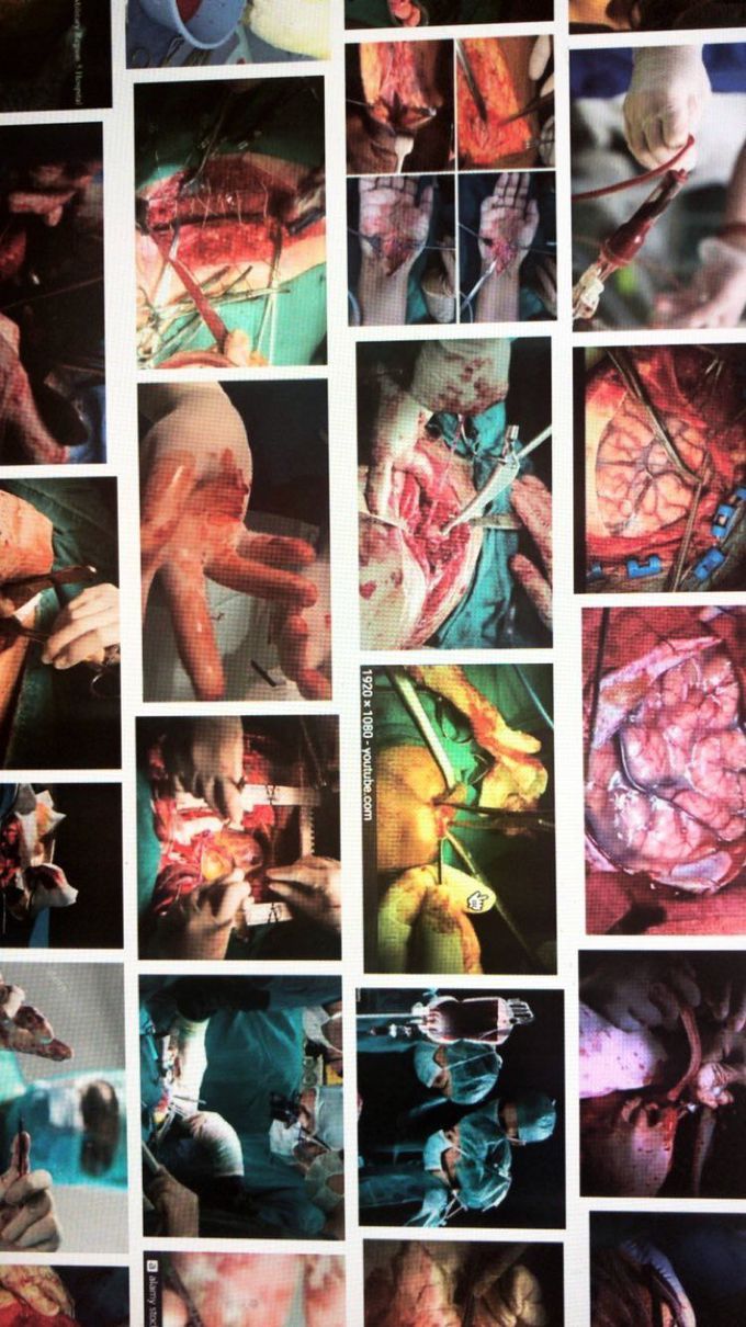 Surgeries