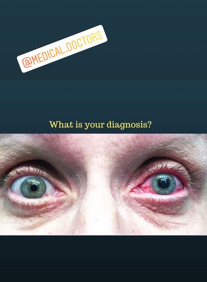 What is your diagnosis and treatment?