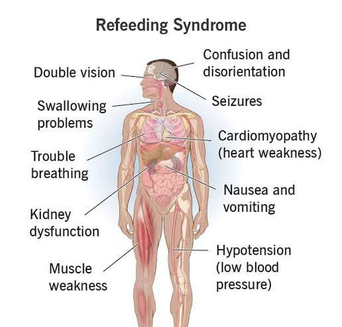 These are the symptoms of Refeeding syndrome