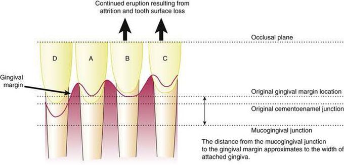 Aging of periodontium