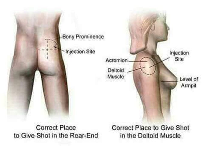 Position of injunction