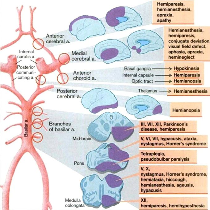 Arteries of brain