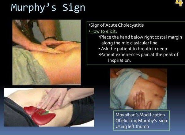 Murphy's Sign - MEDizzy