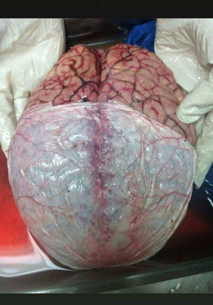 Brain