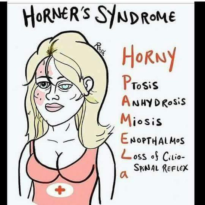 Horner's syndrome